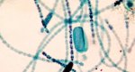 Cyanobacteria